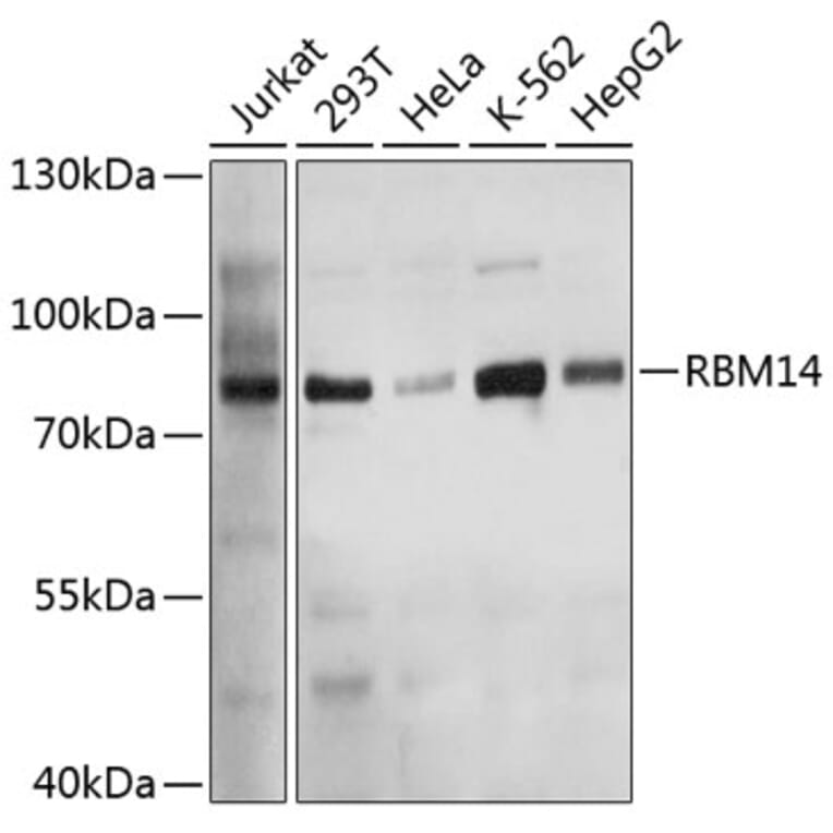 Western Blot - Anti-RBM14 Antibody (A11839) - Antibodies.com