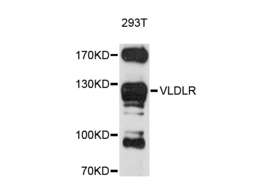 Western Blot - Anti-VLDLR Antibody (A11841) - Antibodies.com