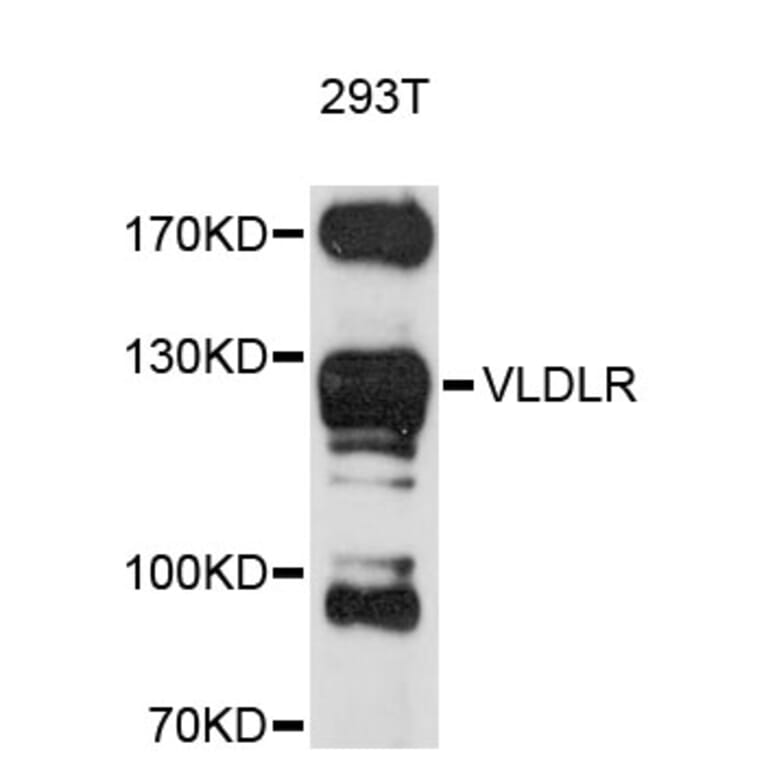 Western Blot - Anti-VLDLR Antibody (A11841) - Antibodies.com