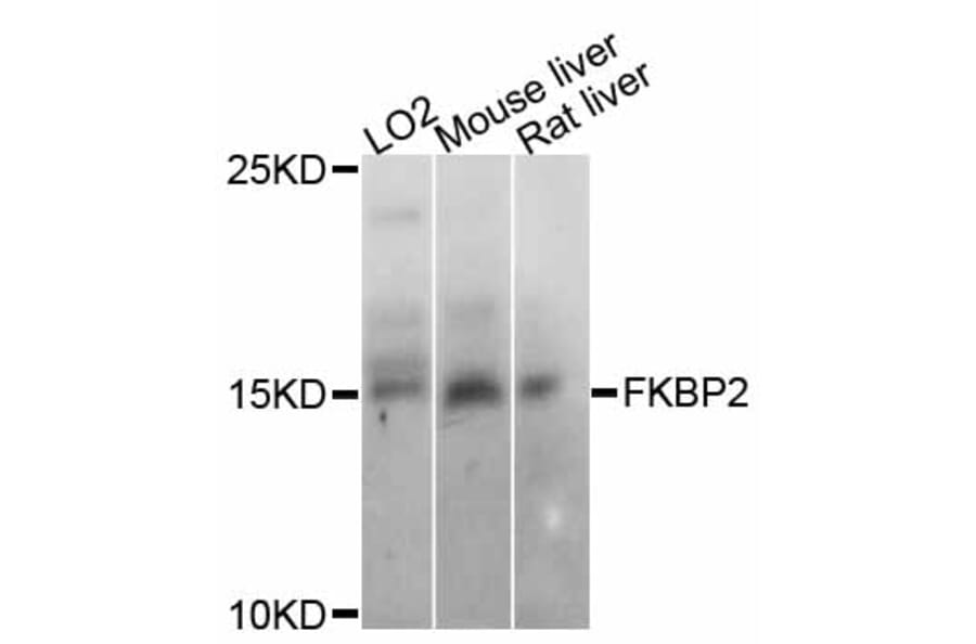 Western Blot - Anti-FKBP2 Antibody (A11845) - Antibodies.com