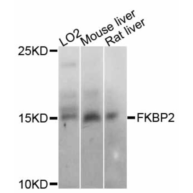 Western Blot - Anti-FKBP2 Antibody (A11845) - Antibodies.com