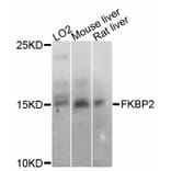 Western Blot - Anti-FKBP2 Antibody (A11845) - Antibodies.com