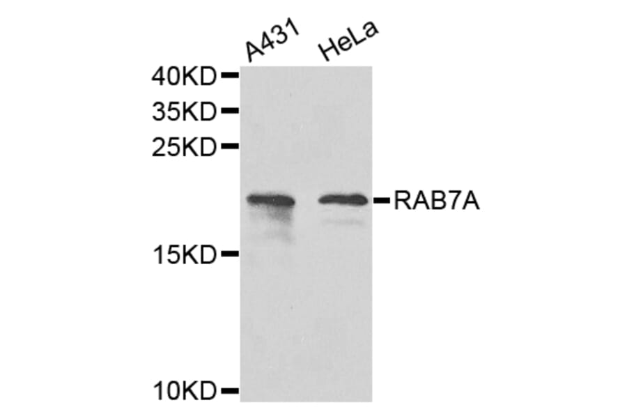 Western Blot - Anti-RAB7A Antibody (A12344) - Antibodies.com