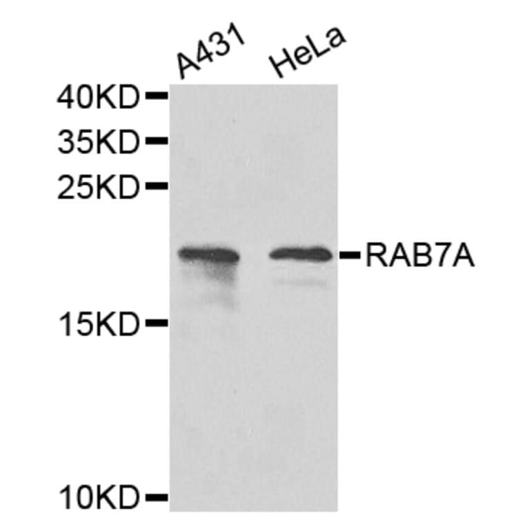 Western Blot - Anti-RAB7A Antibody (A12344) - Antibodies.com