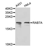 Western Blot - Anti-RAB7A Antibody (A12344) - Antibodies.com