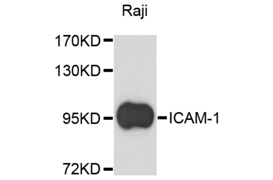 Western Blot - Anti-ICAM-1 Antibody (A11869) - Antibodies.com