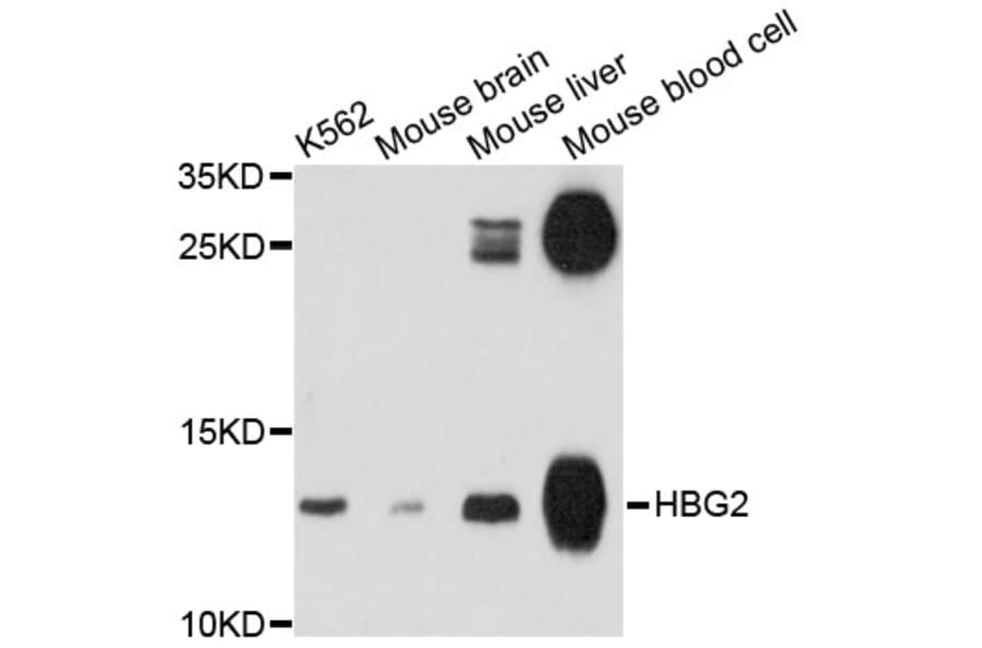 Western Blot - Anti-HBG2 Antibody (A11828) - Antibodies.com