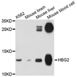 Western Blot - Anti-HBG2 Antibody (A11828) - Antibodies.com