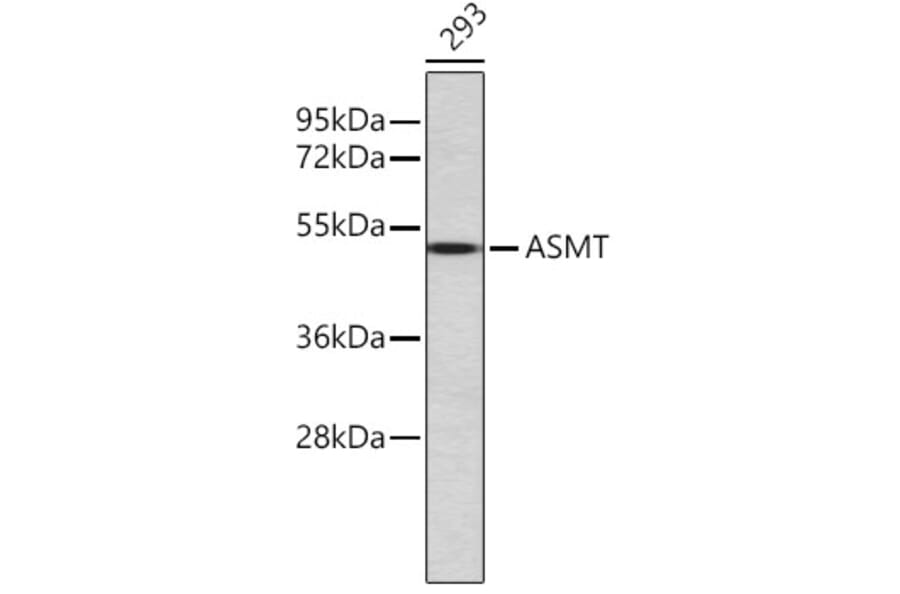 Western Blot - Anti-ASMT Antibody (A80486) - Antibodies.com