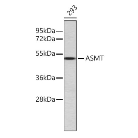 Western Blot - Anti-ASMT Antibody (A80486) - Antibodies.com