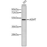 Western Blot - Anti-ASMT Antibody (A80486) - Antibodies.com