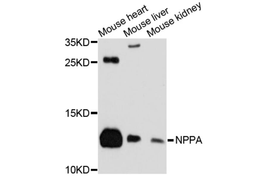 Western Blot - Anti-NPPA Antibody (A11848) - Antibodies.com