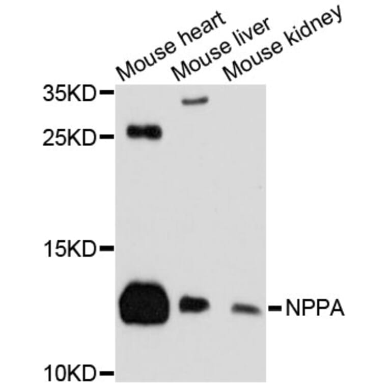 Western Blot - Anti-NPPA Antibody (A11848) - Antibodies.com