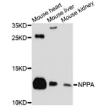 Western Blot - Anti-NPPA Antibody (A11848) - Antibodies.com