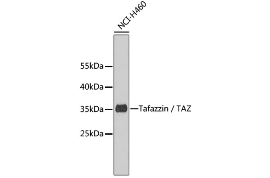 Western Blot - Anti-Tafazzin Antibody (A7162) - Antibodies.com