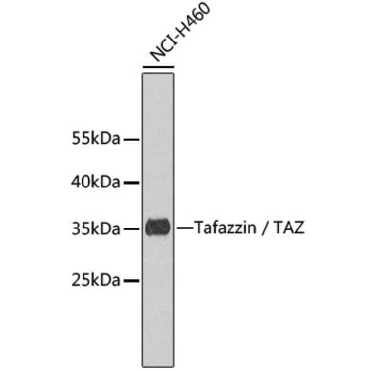 Western Blot - Anti-Tafazzin Antibody (A7162) - Antibodies.com