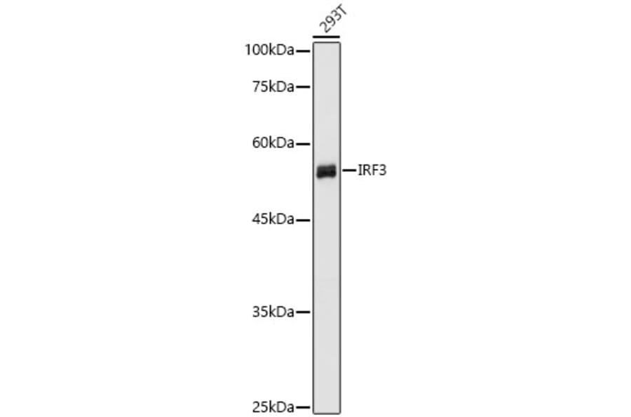 Western Blot - Anti-IRF3 Antibody (A80489) - Antibodies.com