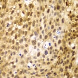 Immunohistochemistry - Anti-IRF3 Antibody (A80489) - Antibodies.com