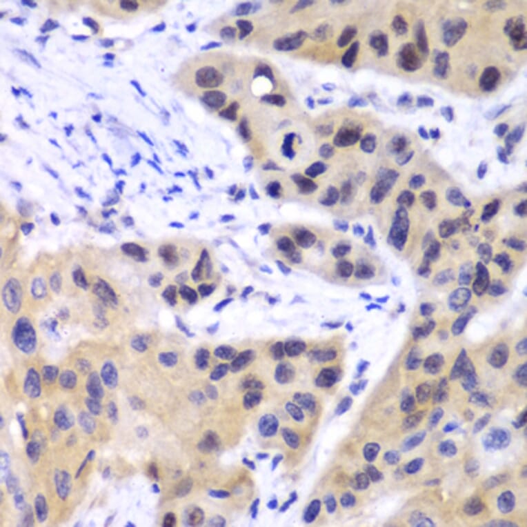 Immunohistochemistry - Anti-IRF3 Antibody (A80489) - Antibodies.com