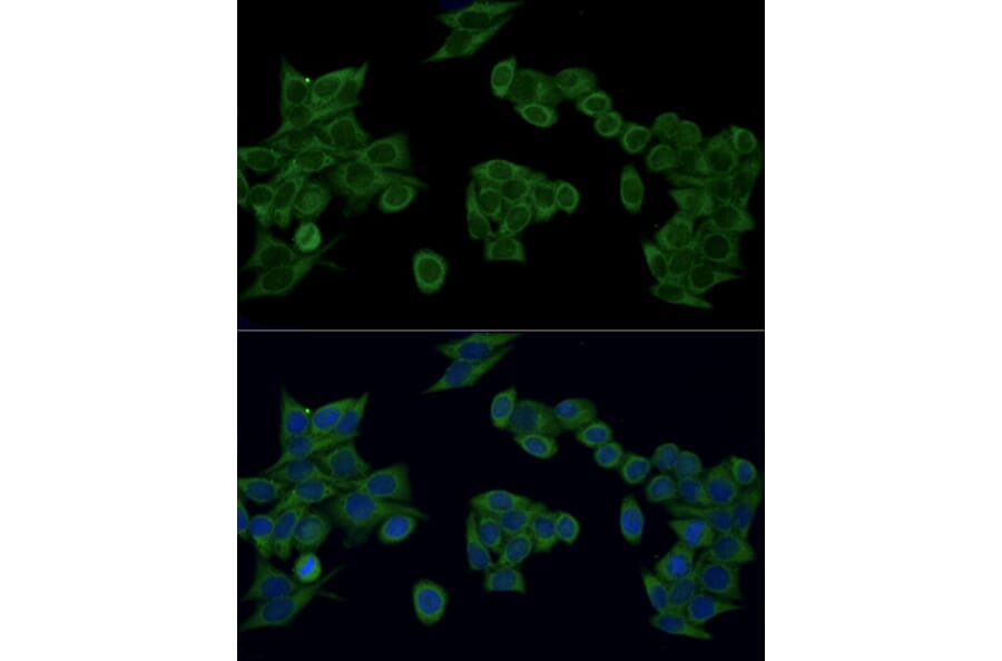 Immunofluorescence - Anti-IRF3 Antibody (A80489) - Antibodies.com