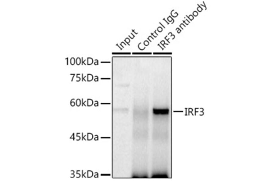 Immunoprecipitation - Anti-IRF3 Antibody (A80489) - Antibodies.com