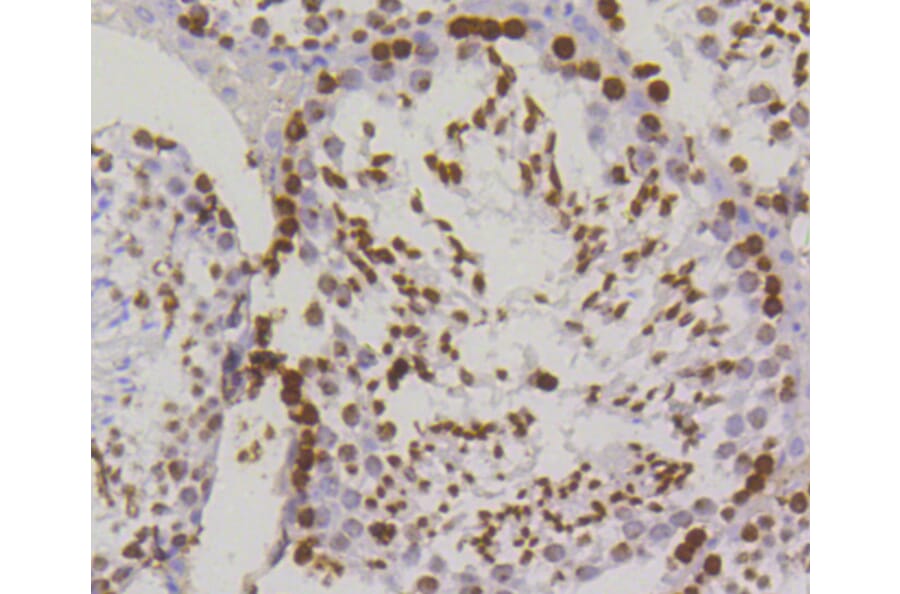 Immunohistochemistry - Anti-Histone H2AX (phospho S139) Antibody (AP0640) - Antibodies.com
