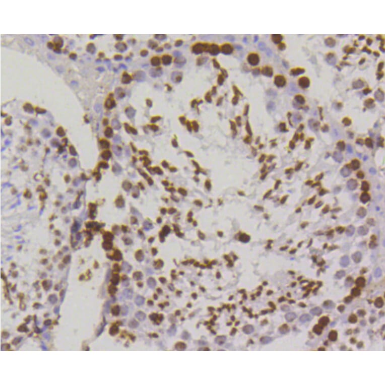 Immunohistochemistry - Anti-Histone H2AX (phospho S139) Antibody (AP0640) - Antibodies.com