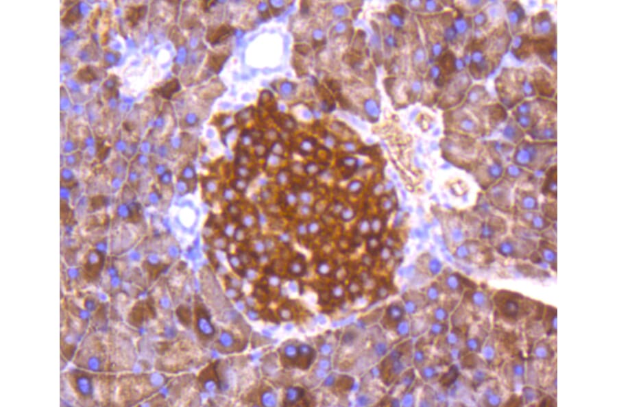 Immunohistochemistry - Anti-FOXO3 (phospho S253) Antibody (AP0628) - Antibodies.com
