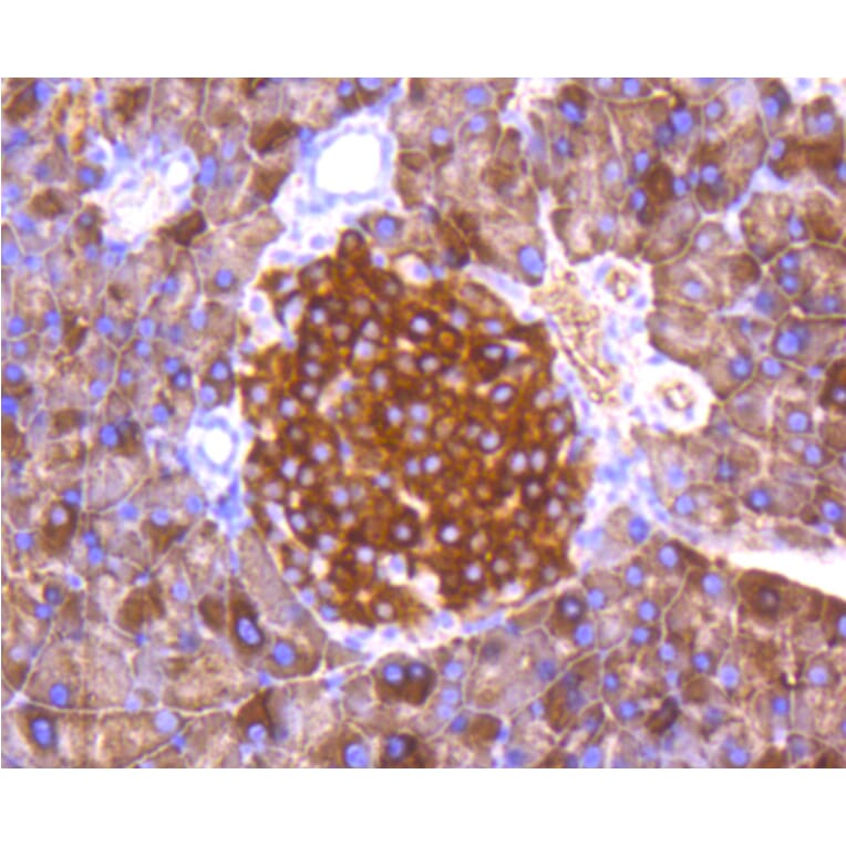Immunohistochemistry - Anti-FOXO3 (phospho S253) Antibody (AP0628) - Antibodies.com
