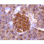 Immunohistochemistry - Anti-FOXO3 (phospho S253) Antibody (AP0628) - Antibodies.com