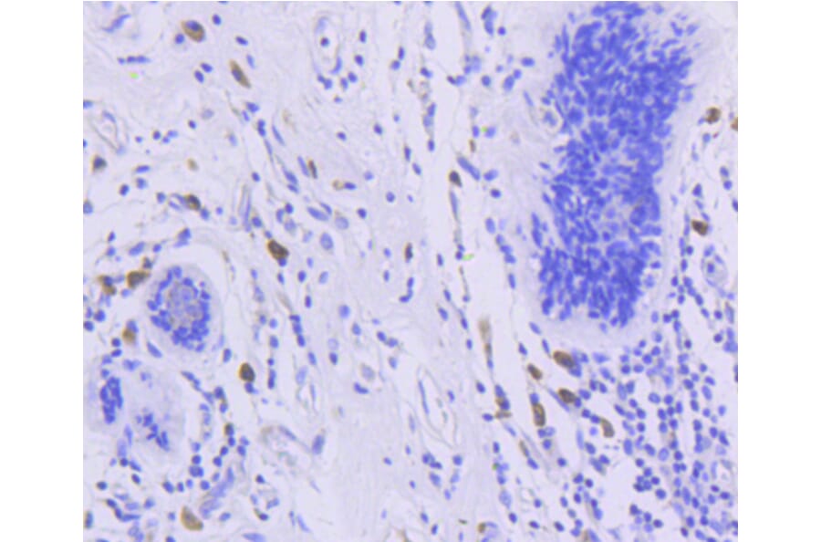 Immunohistochemistry - Anti-FOXO3 (phospho S253) Antibody (AP0628) - Antibodies.com