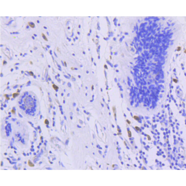 Immunohistochemistry - Anti-FOXO3 (phospho S253) Antibody (AP0628) - Antibodies.com