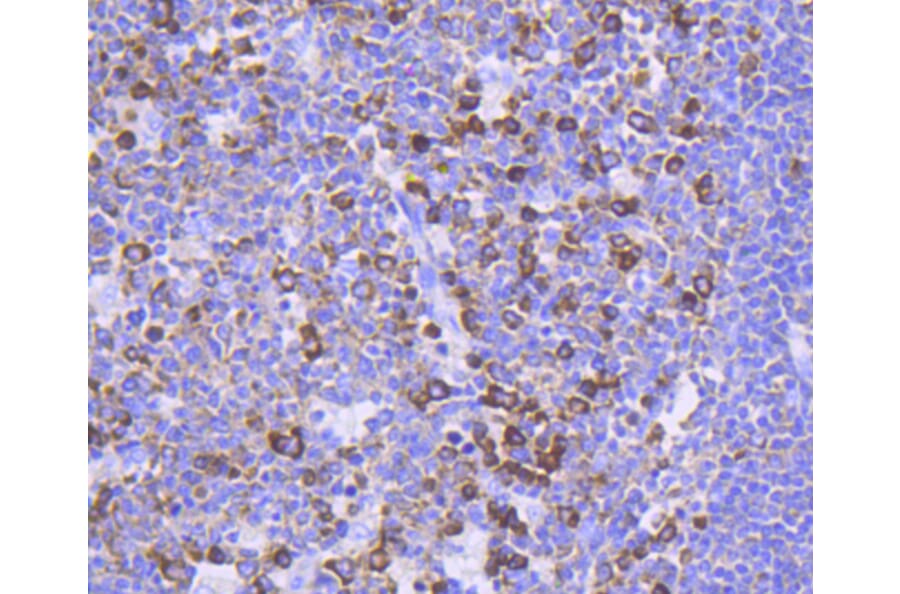 Immunohistochemistry - Anti-FOXO3 (phospho S253) Antibody (AP0628) - Antibodies.com