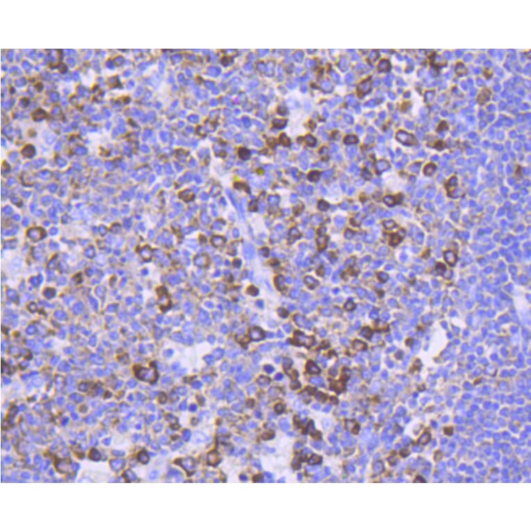 Immunohistochemistry - Anti-FOXO3 (phospho S253) Antibody (AP0628) - Antibodies.com