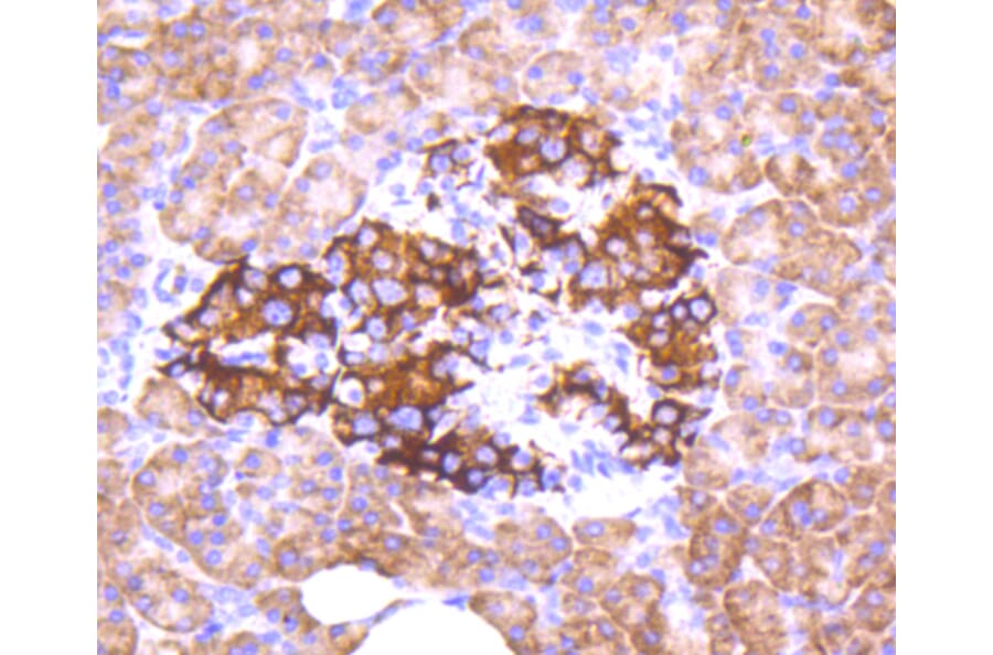 Immunohistochemistry - Anti-FOXO3 (phospho S253) Antibody (AP0628) - Antibodies.com