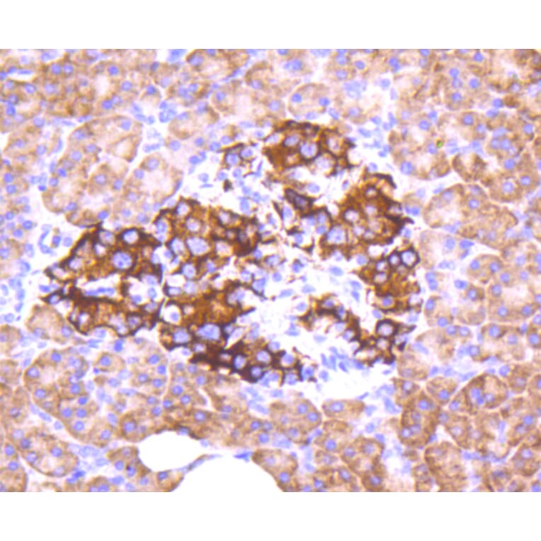 Immunohistochemistry - Anti-FOXO3 (phospho S253) Antibody (AP0628) - Antibodies.com