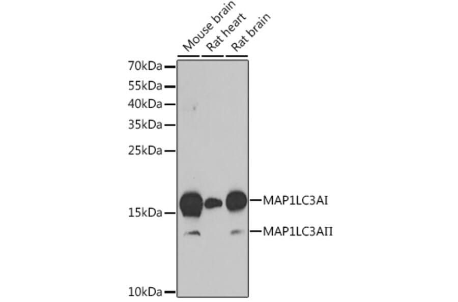 Western Blot - Anti-MAP1LC3A Antibody (A80492) - Antibodies.com