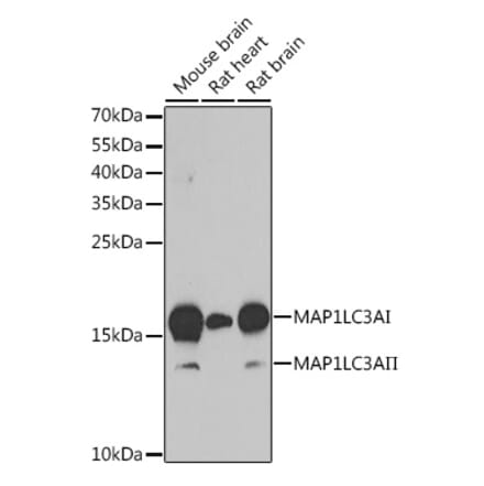 Western Blot - Anti-MAP1LC3A Antibody (A80492) - Antibodies.com