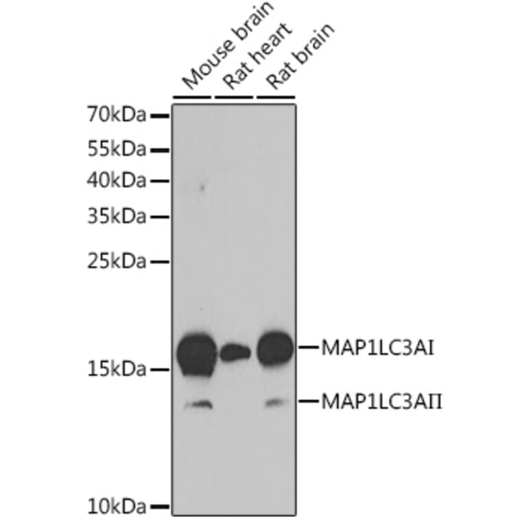 Western Blot - Anti-MAP1LC3A Antibody (A80492) - Antibodies.com