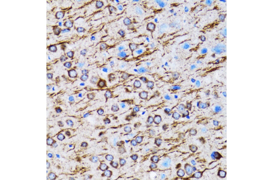 Immunohistochemistry - Anti-MAP1LC3A Antibody (A80492) - Antibodies.com
