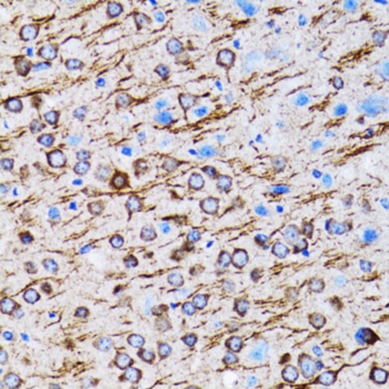 Immunohistochemistry - Anti-MAP1LC3A Antibody (A80492) - Antibodies.com