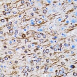 Immunohistochemistry - Anti-MAP1LC3A Antibody (A80492) - Antibodies.com