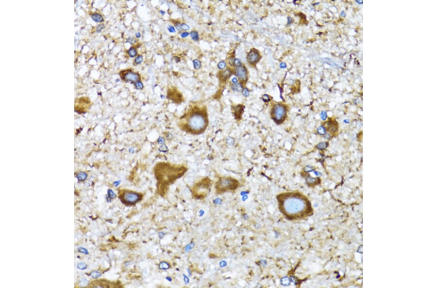 Immunohistochemistry - Anti-MAP1LC3A Antibody (A80492) - Antibodies.com