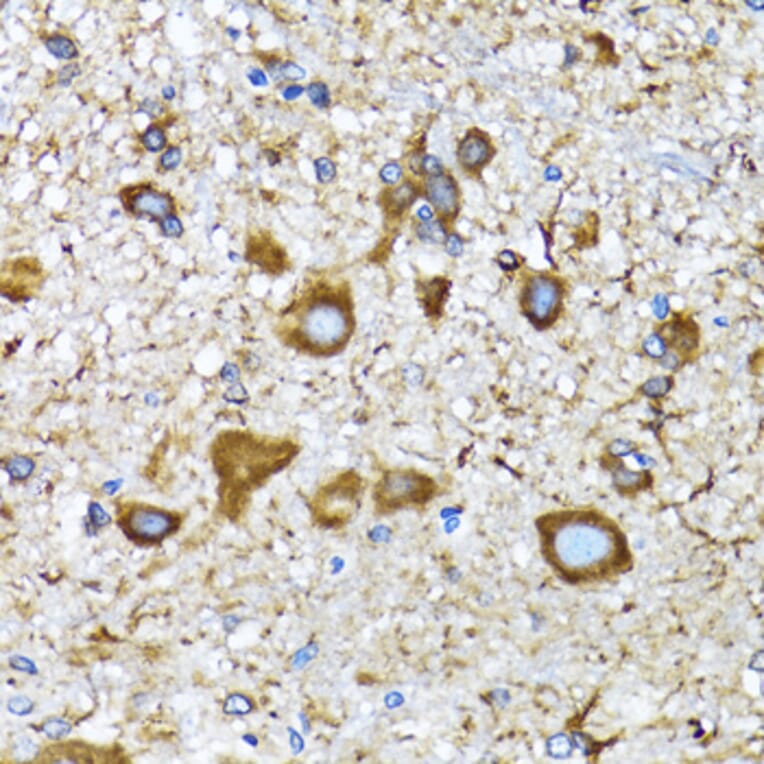 Immunohistochemistry - Anti-MAP1LC3A Antibody (A80492) - Antibodies.com