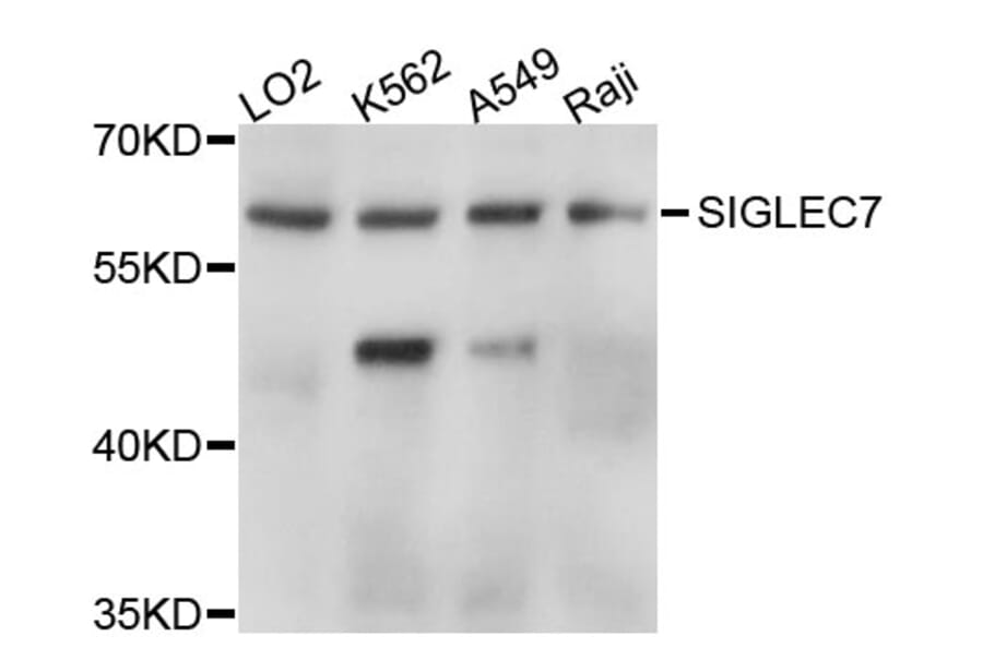 Western Blot - Anti-SIGLEC7 Antibody (A11813) - Antibodies.com