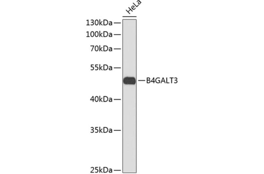 Western Blot - Anti-B4GALT3 Antibody (A11939) - Antibodies.com