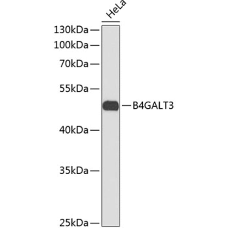 Western Blot - Anti-B4GALT3 Antibody (A11939) - Antibodies.com