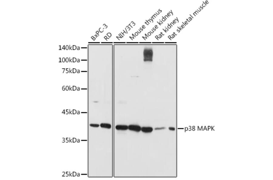 Western Blot - Anti-p38 alpha / MAPK14 Antibody (A80496) - Antibodies.com