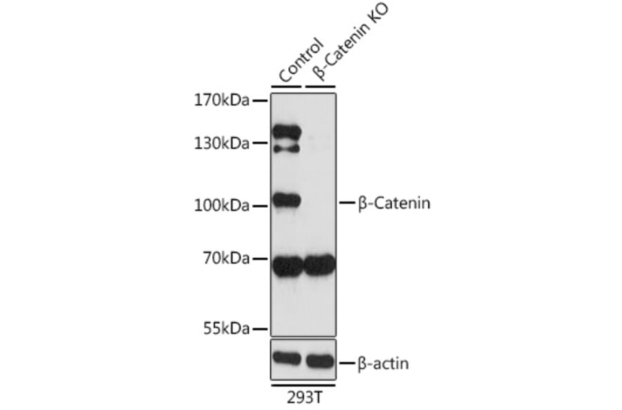 Western Blot - Anti-beta Catenin Antibody (A80497) - Antibodies.com
