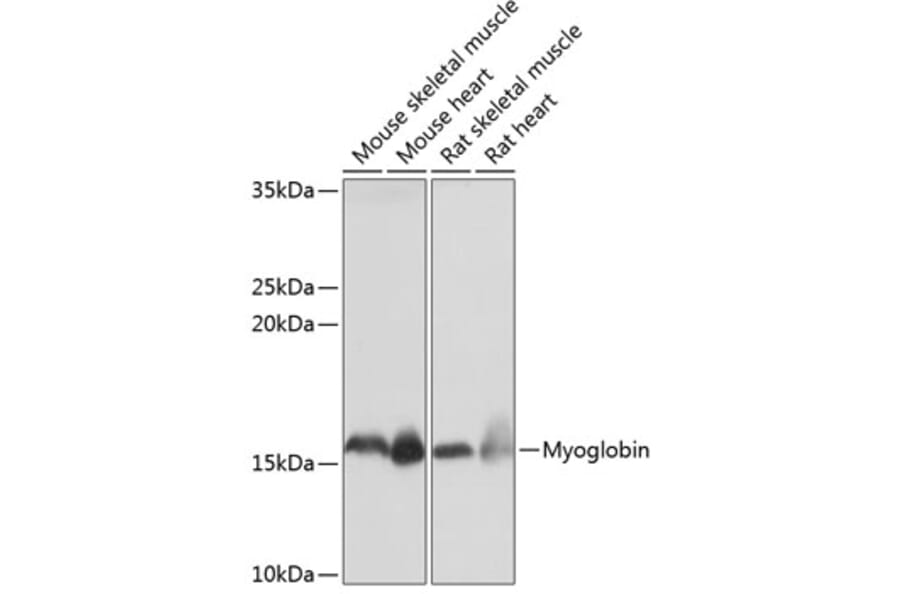 Western Blot - Anti-Myoglobin Antibody [ARC0582] (A80498) - Antibodies.com